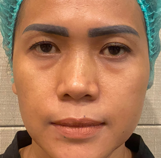 Before/After Image